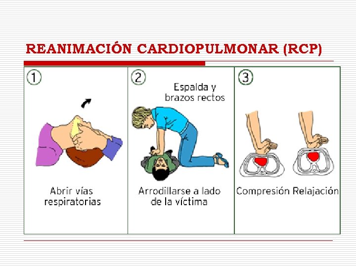 REANIMACIÓN CARDIOPULMONAR (RCP) 