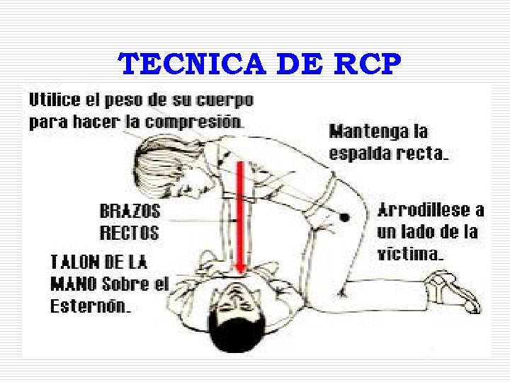 TECNICA DE RCP 