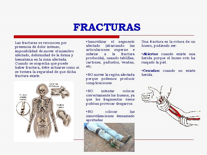 FRACTURAS Las fracturas se reconocen por presencia de dolor intenso, imposibilidad de mover el