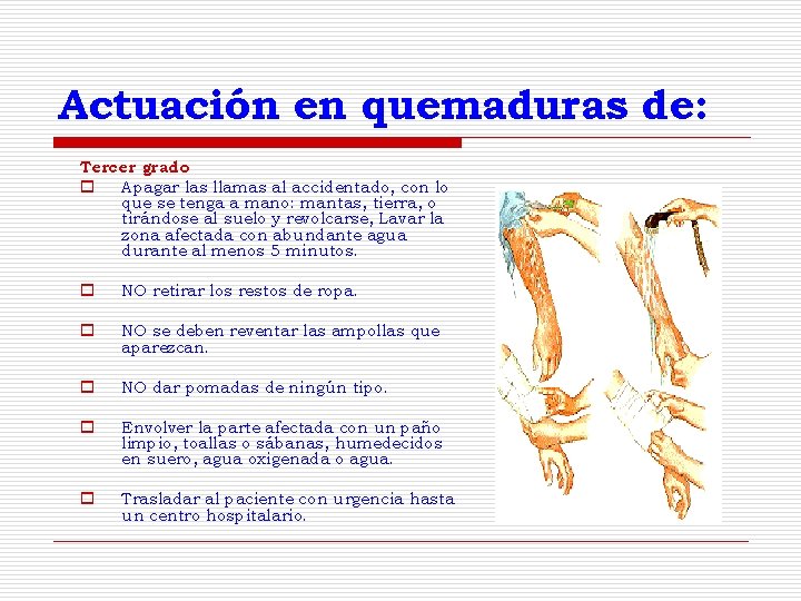 Actuación en quemaduras de: Tercer grado o Apagar las llamas al accidentado, con lo