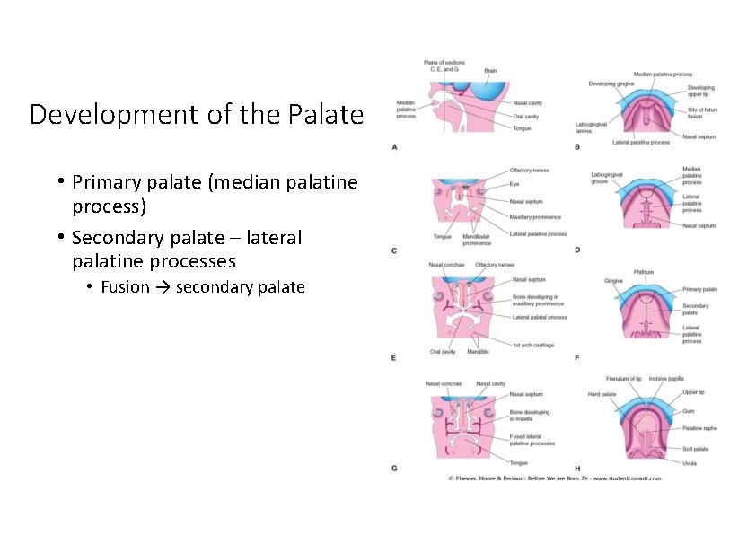 Development of the Palate • Primary palate (median palatine process) • Secondary palate –