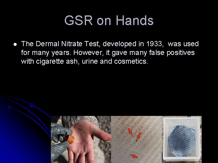 GSR on Hands l The Dermal Nitrate Test, developed in 1933, was used for