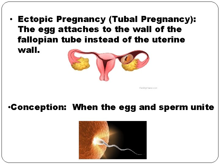  • Ectopic Pregnancy (Tubal Pregnancy): The egg attaches to the wall of the