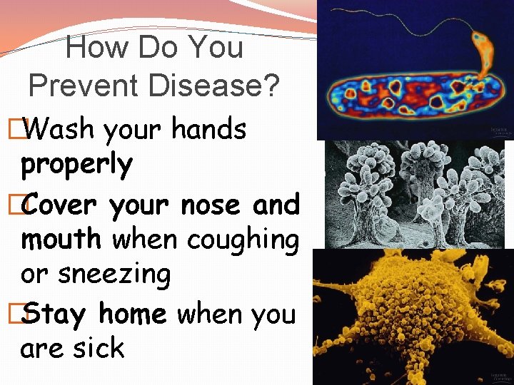 How Do You Prevent Disease? �Wash your hands properly �Cover your nose and mouth
