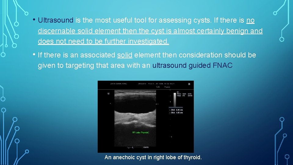 • Ultrasound is the most useful tool for assessing cysts. If there is • Ultrasound is the most useful tool for assessing cysts. If there is
