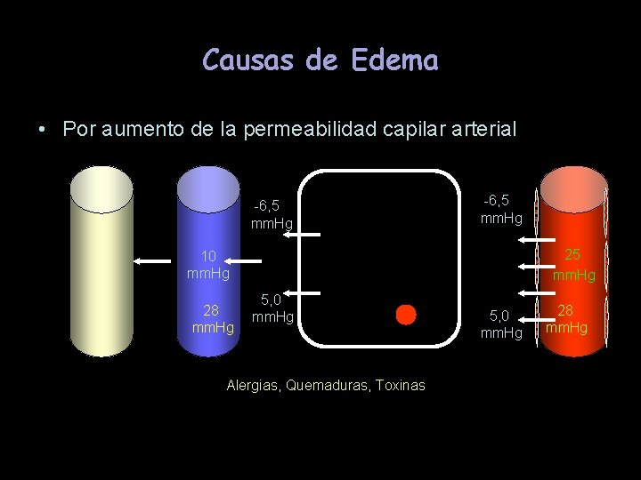 Causas de Edema • Por aumento de la permeabilidad capilar arterial -6, 5 mm.