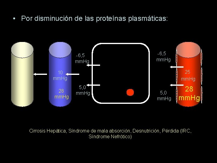  • Por disminución de las proteínas plasmáticas: -6, 5 mm. Hg 25 mm.