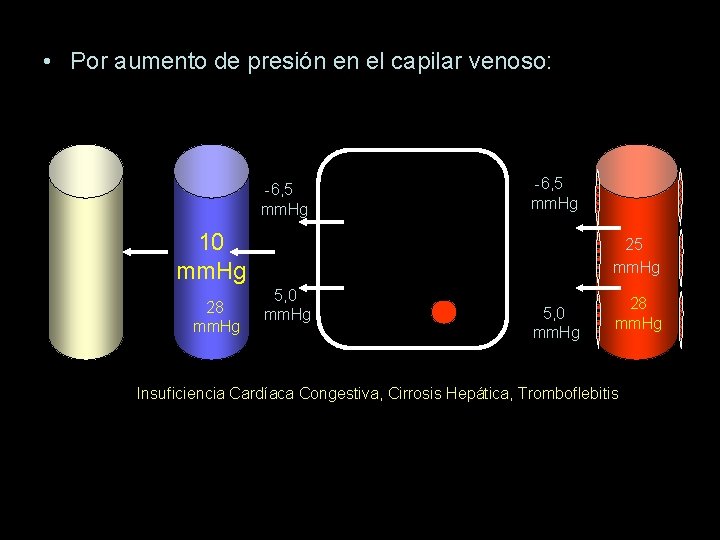  • Por aumento de presión en el capilar venoso: -6, 5 mm. Hg