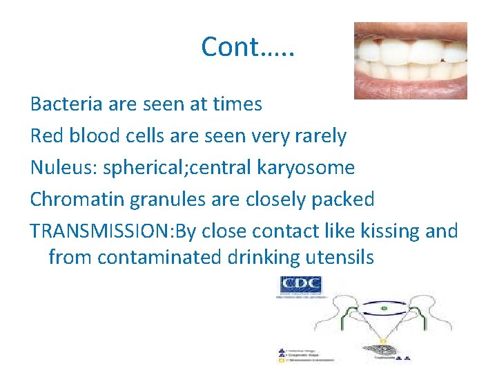 Cont…. . Bacteria are seen at times Red blood cells are seen very rarely