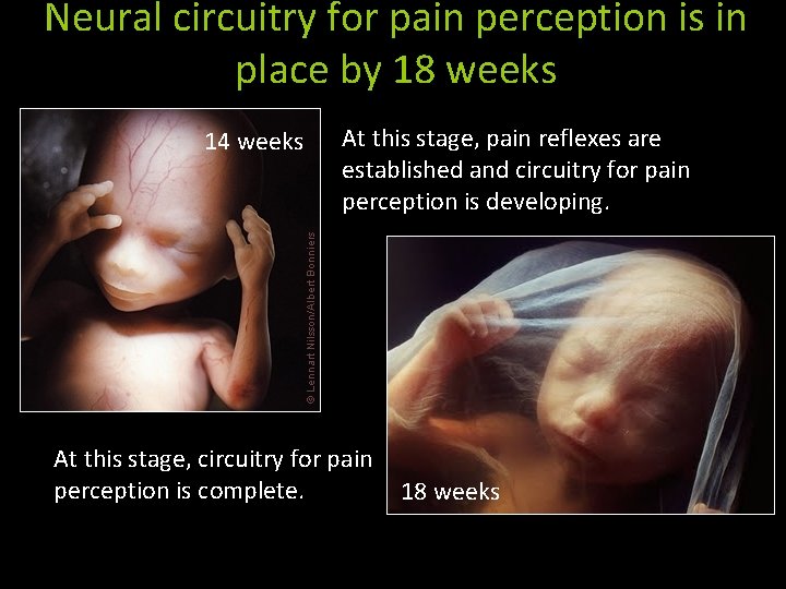 Neural circuitry for pain perception is in place by 18 weeks 14 weeks At