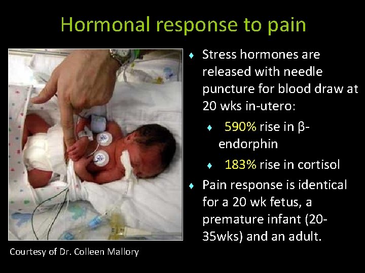 Hormonal response to pain ♦ ♦ Courtesy of Dr. Colleen Mallory Stress hormones are