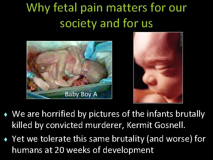 Why fetal pain matters for our society and for us Baby Boy A ♦