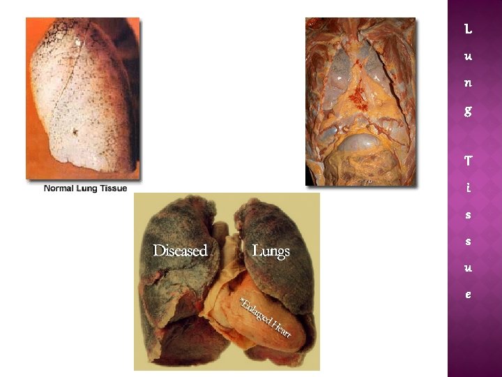 L u n g T i s s u e 