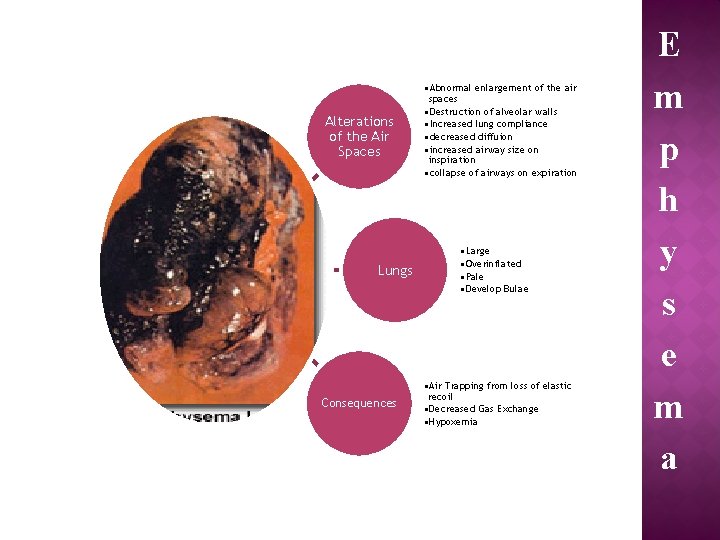 Alterations of the Air Spaces Lungs Consequences • Abnormal enlargement of the air spaces