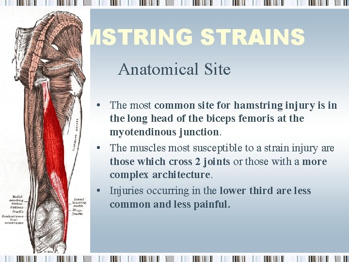 HAMSTRING STRAINS Anatomical Site • The most common site for hamstring injury is in