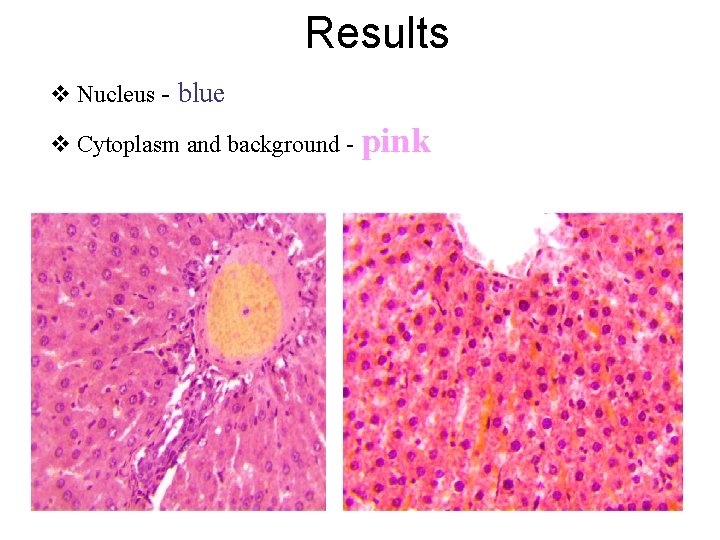 Results v Nucleus - blue v Cytoplasm and background - pink 
