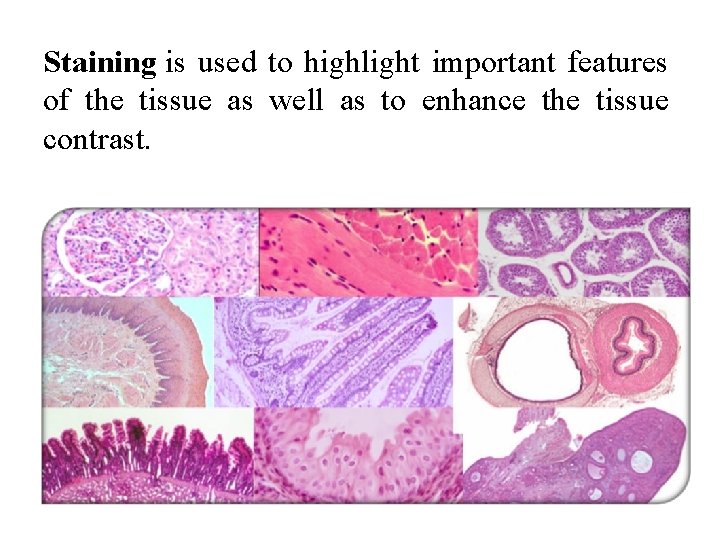 Staining is used to highlight important features of the tissue as well as to