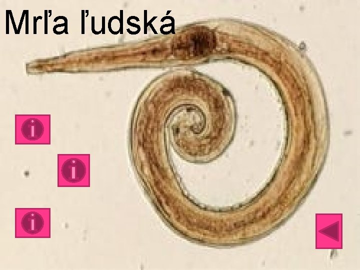 Mrľa ľudská 