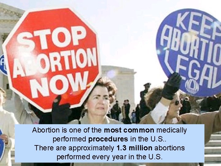 Abortion is one of the most common medically performed procedures in the U. S.