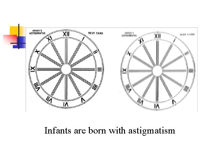 Infants are born with astigmatism 