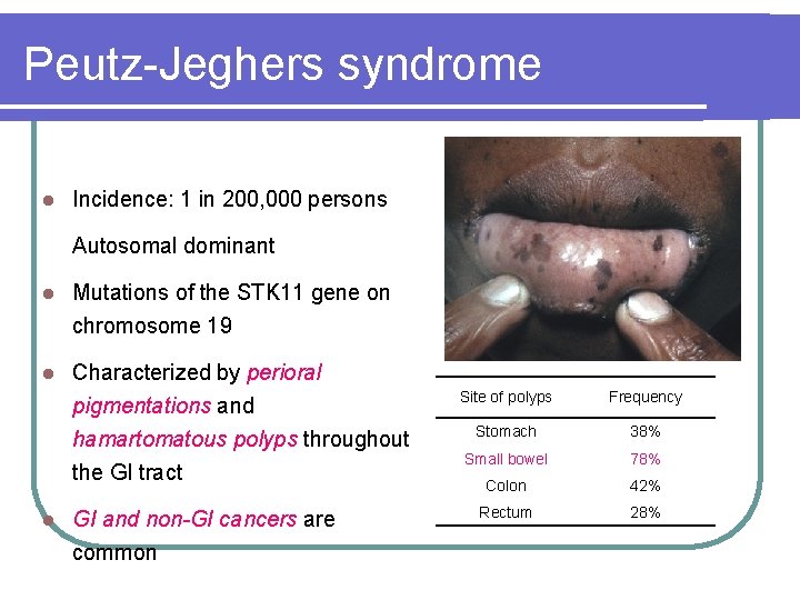 Peutz-Jeghers syndrome l Incidence: 1 in 200, 000 persons Autosomal dominant l Mutations of Peutz-Jeghers syndrome l Incidence: 1 in 200, 000 persons Autosomal dominant l Mutations of