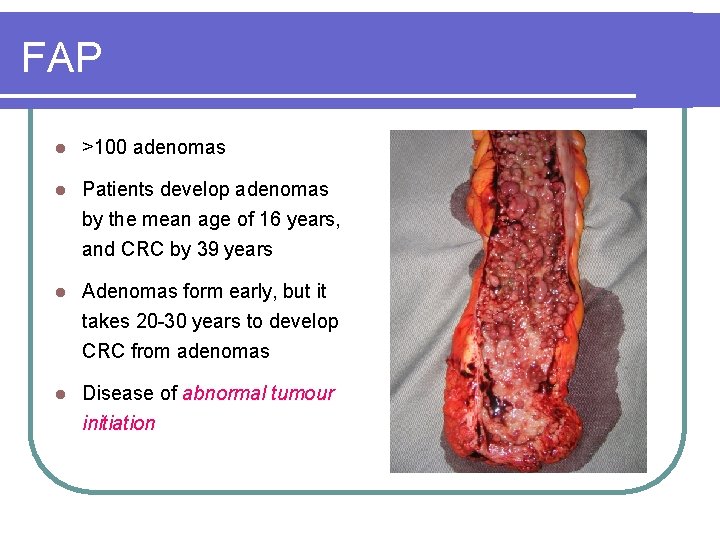 FAP l >100 adenomas l Patients develop adenomas by the mean age of 16 FAP l >100 adenomas l Patients develop adenomas by the mean age of 16