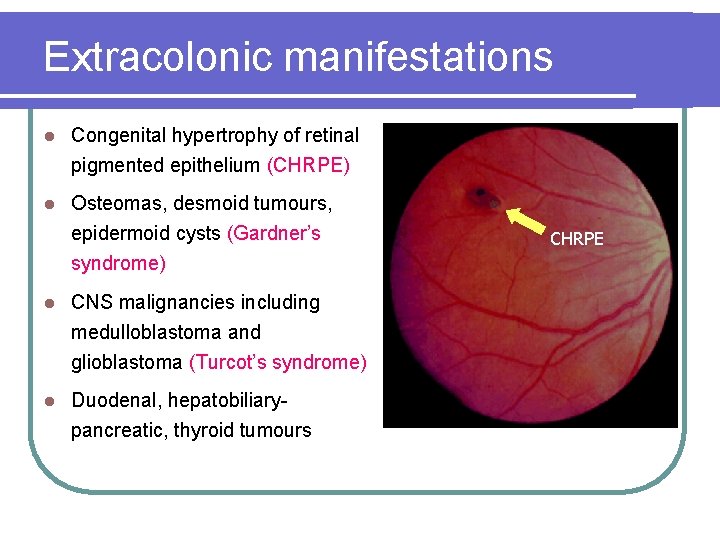 Extracolonic manifestations l Congenital hypertrophy of retinal pigmented epithelium (CHRPE) l Osteomas, desmoid tumours, Extracolonic manifestations l Congenital hypertrophy of retinal pigmented epithelium (CHRPE) l Osteomas, desmoid tumours,