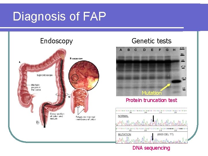 Diagnosis of FAP Endoscopy Genetic tests Mutation Protein truncation test DNA sequencing Diagnosis of FAP Endoscopy Genetic tests Mutation Protein truncation test DNA sequencing