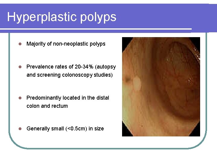 Hyperplastic polyps l Majority of non-neoplastic polyps l Prevalence rates of 20 -34% (autopsy Hyperplastic polyps l Majority of non-neoplastic polyps l Prevalence rates of 20 -34% (autopsy