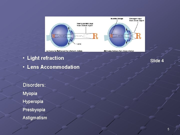 • Light refraction Slide 4 • Lens Accommodation Disorders: Myopia Hyperopia Presbyopia Astigmatism