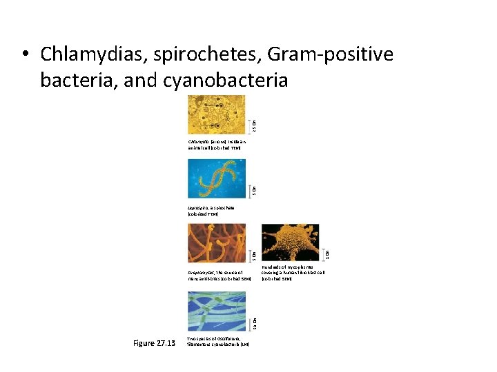 2. 5 �m • Chlamydias, spirochetes, Gram-positive bacteria, and cyanobacteria 5 �m Chlamydia (arrows)