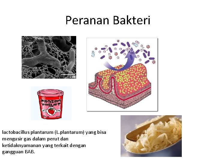 Peranan Bakteri Bifidobacterium lactobacillus plantarum (L. plantarum) yang bisa mengusir gas dalam perut dan
