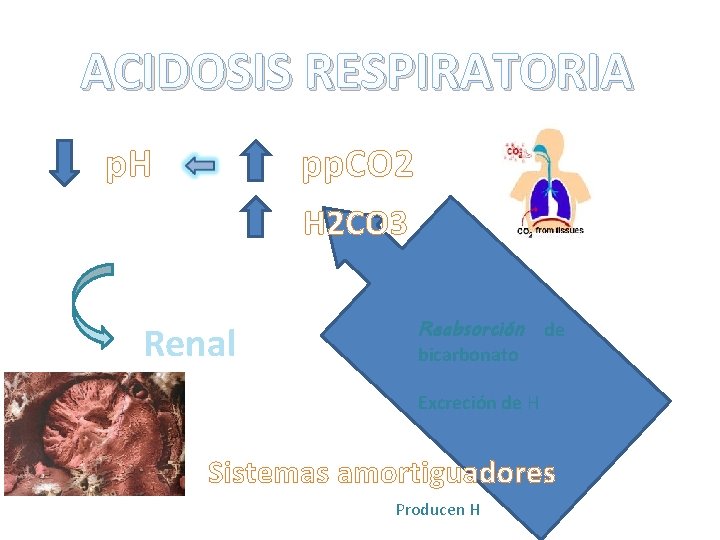 ACIDOSIS RESPIRATORIA p. H pp. CO 2 H 2 CO 3 Renal Reabsorción de