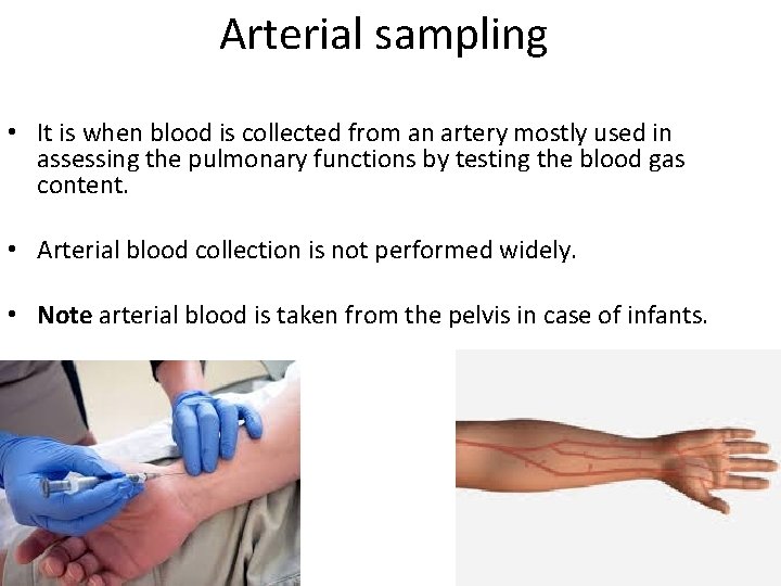 Arterial sampling • It is when blood is collected from an artery mostly used