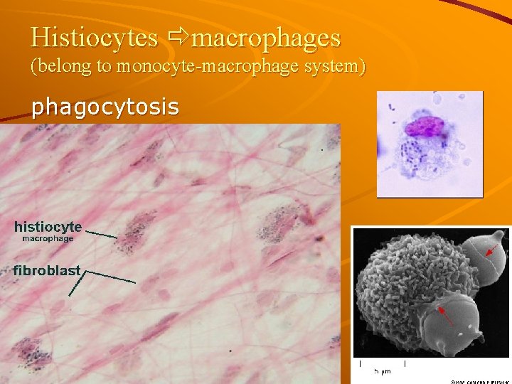 Histiocytes macrophages (belong to monocyte-macrophage system) phagocytosis 