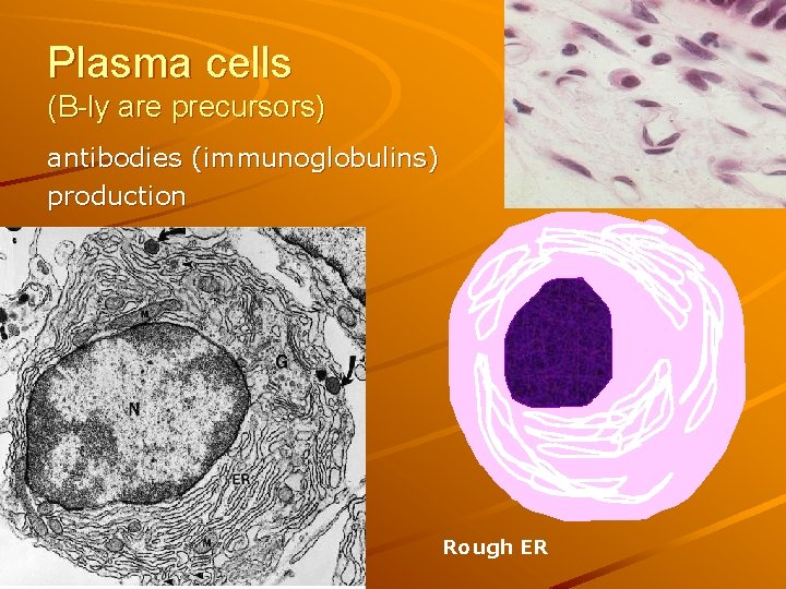 Plasma cells (B-ly are precursors) antibodies (immunoglobulins) production Rough ER 