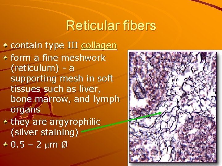 Reticular fibers contain type III collagen form a fine meshwork (reticulum) - a supporting
