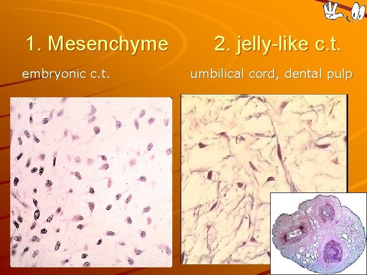 1. Mesenchyme embryonic c. t. 2. jelly-like c. t. umbilical cord, dental pulp 