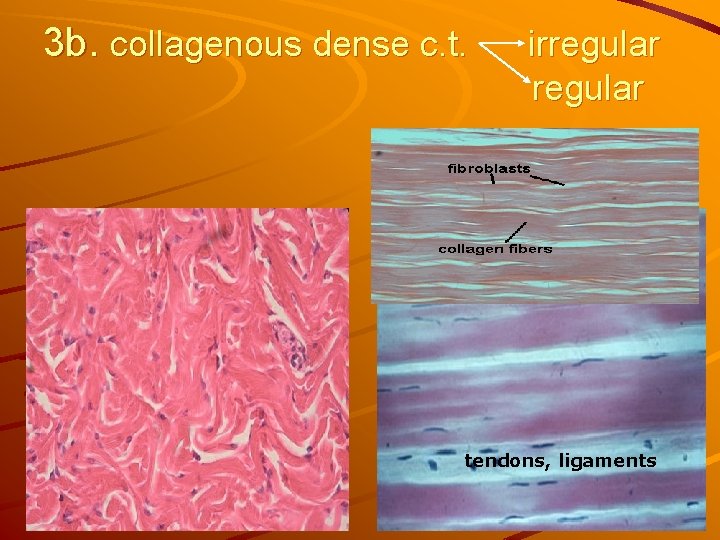 3 b. collagenous dense c. t. irregular tendons, ligaments 