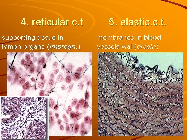 4. reticular c. t supporting tissue in lymph organs (impregn. ) 5. elastic. c.