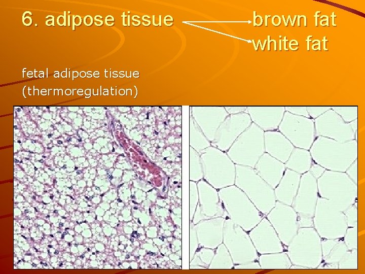 6. adipose tissue fetal adipose tissue (thermoregulation) brown fat white fat 
