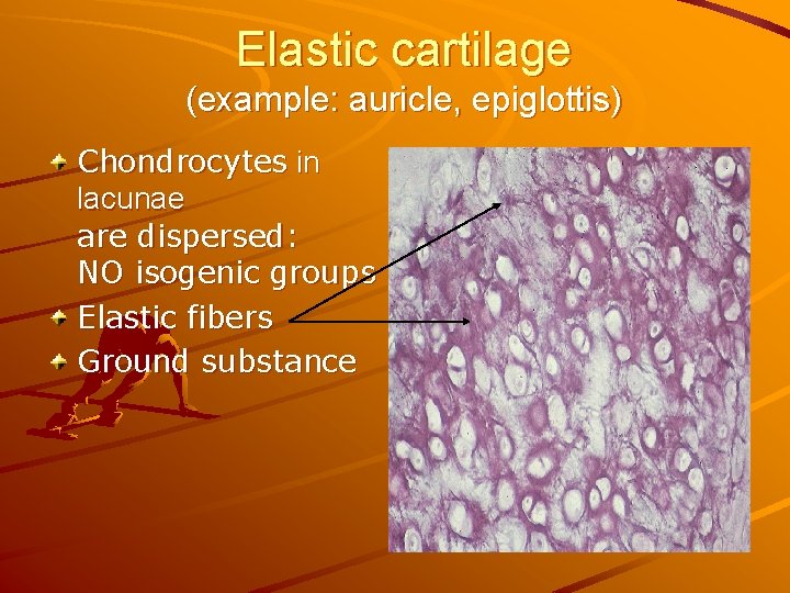 Elastic cartilage (example: auricle, epiglottis) Chondrocytes in lacunae are dispersed: NO isogenic groups Elastic