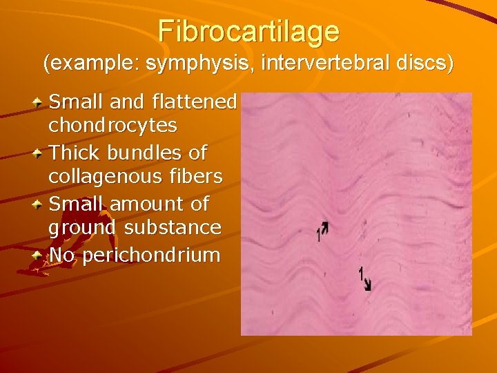 Fibrocartilage (example: symphysis, intervertebral discs) Small and flattened chondrocytes Thick bundles of collagenous fibers