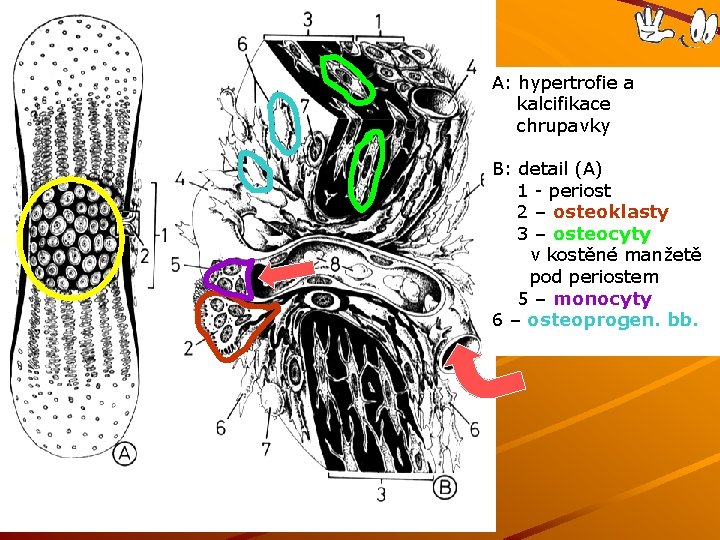 A: hypertrofie a kalcifikace chrupavky B: detail (A) 1 - periost 2 – osteoklasty