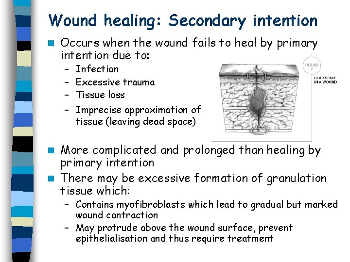 Wound healing: Secondary intention n Occurs when the wound fails to heal by primary