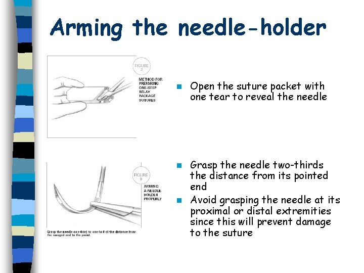 Arming the needle-holder n Open the suture packet with one tear to reveal the