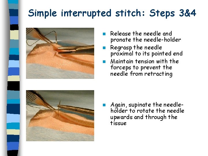 Simple interrupted stitch: Steps 3&4 Release the needle and pronate the needle-holder n Regrasp