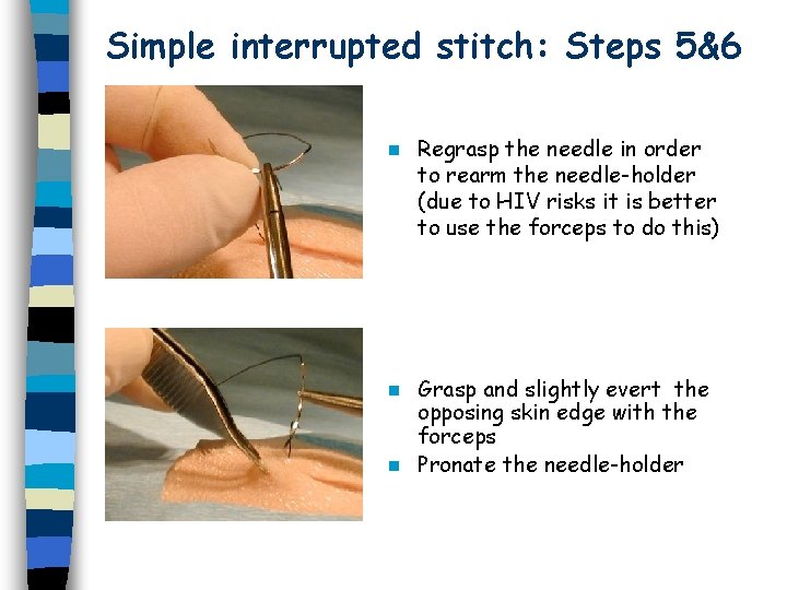 Simple interrupted stitch: Steps 5&6 n Regrasp the needle in order to rearm the