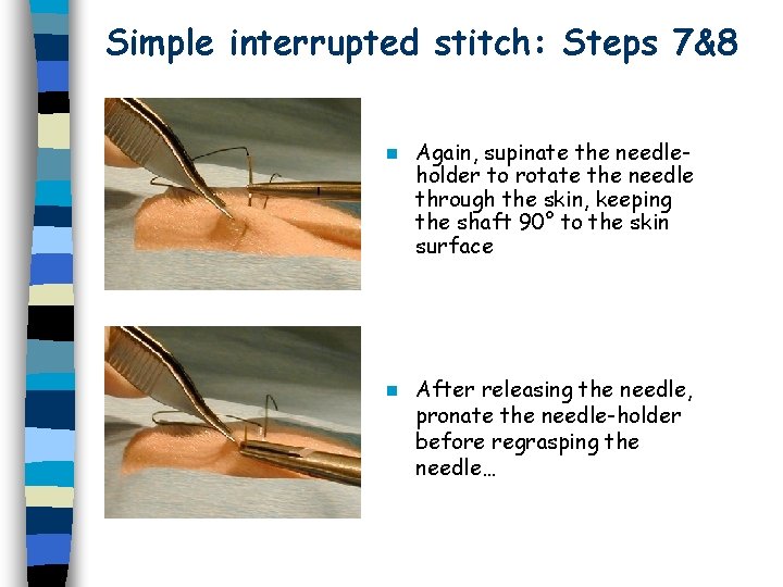 Simple interrupted stitch: Steps 7&8 n Again, supinate the needleholder to rotate the needle