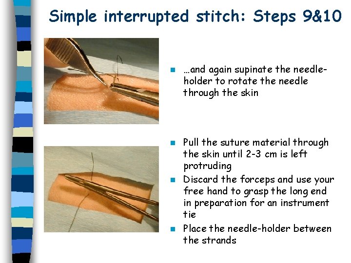 Simple interrupted stitch: Steps 9&10 n …and again supinate the needleholder to rotate the